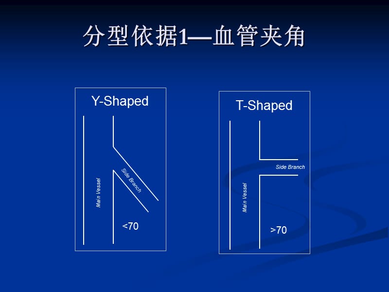 最新：冠脉分叉病变术式-文档资料.ppt_第2页