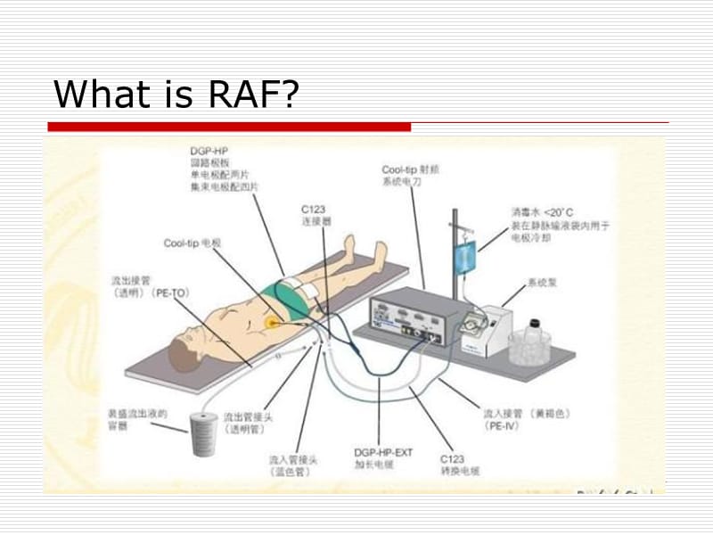 射频消融在实体肿瘤中的应用-PPT文档.ppt_第1页