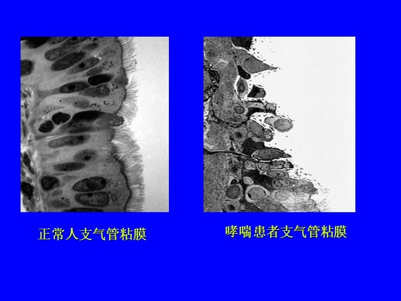 最新：支气管哮喘吸入治疗-文档资料.ppt_第2页