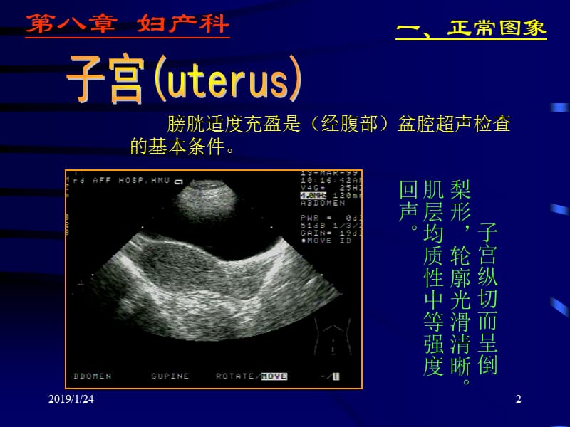 妇产科超声检查-PPT文档.ppt_第2页