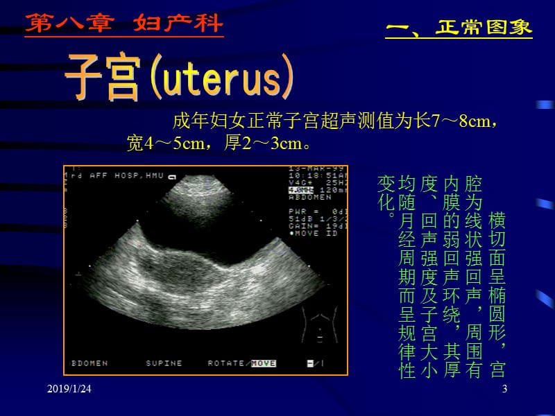 妇产科超声检查-PPT文档.ppt_第3页