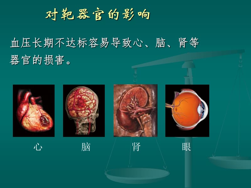 社区高血压综合管理的主要内容与措施-精选文档.ppt_第3页