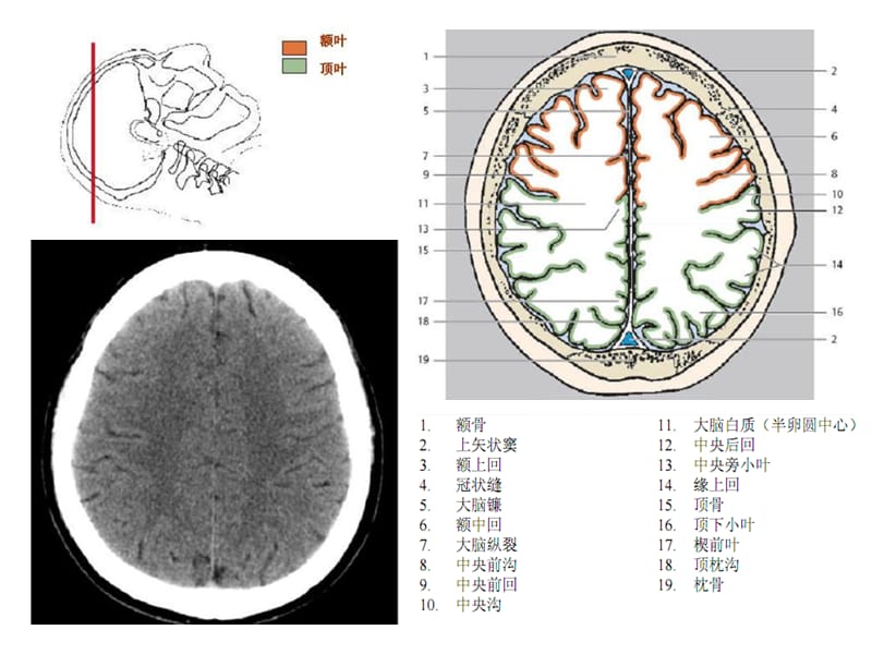 头颈CT-MRI解剖图解第一季-文档资料.ppt_第2页