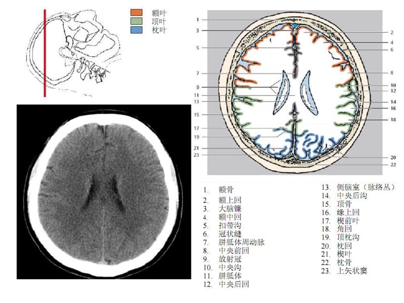 头颈CT-MRI解剖图解第一季-文档资料.ppt_第3页