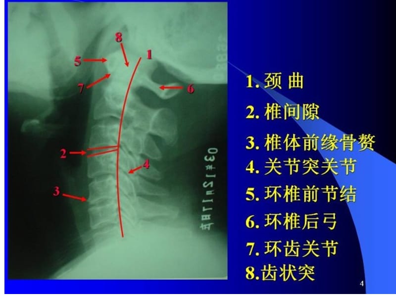 最新颈椎X片课件-PPT文档.ppt_第1页