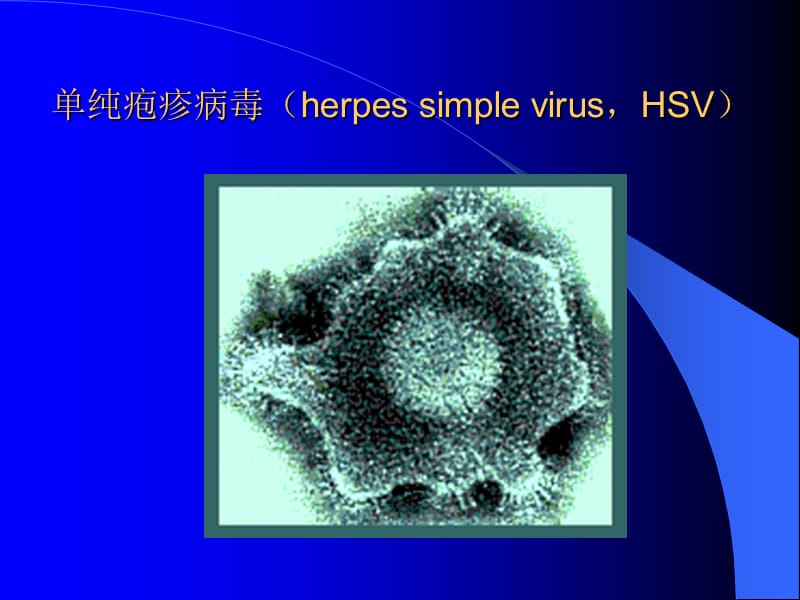 疱疹病毒介绍-文档资料.ppt_第2页