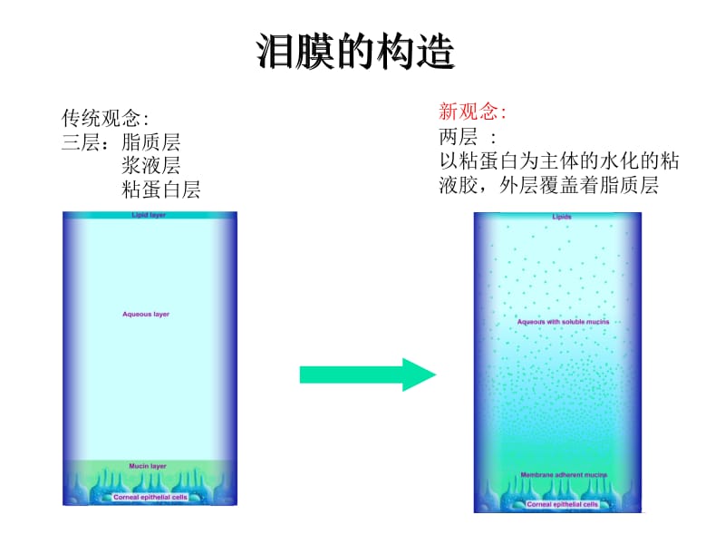 干眼的诊疗新进展与相关疾病-精选文档.ppt_第2页