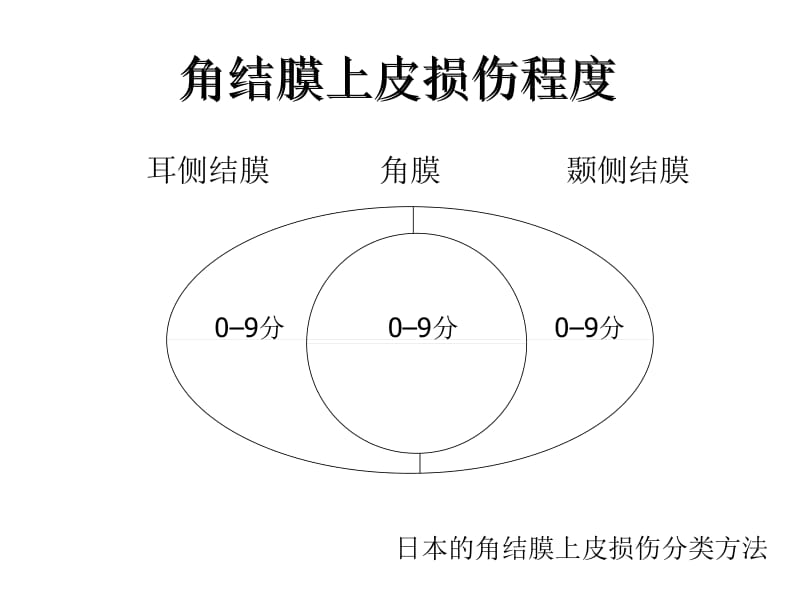 干眼的诊疗新进展与相关疾病-精选文档.ppt_第3页