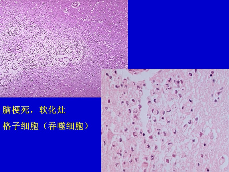 最新：病理学实习镜下--神经系统-文档资料.ppt_第1页