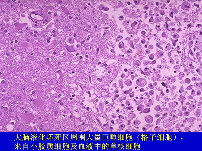 最新：病理学实习镜下--神经系统-文档资料.ppt_第2页