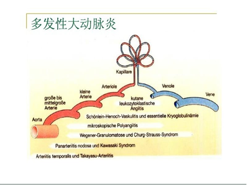 最新多发大动脉炎-PPT文档.ppt_第2页