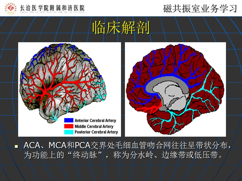 最新：脑分水岭梗死2018.3.16ppt课件-文档资料.ppt_第3页