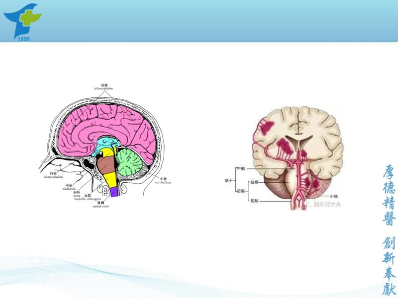 最新小脑出血诊疗规范-PPT文档.ppt_第3页