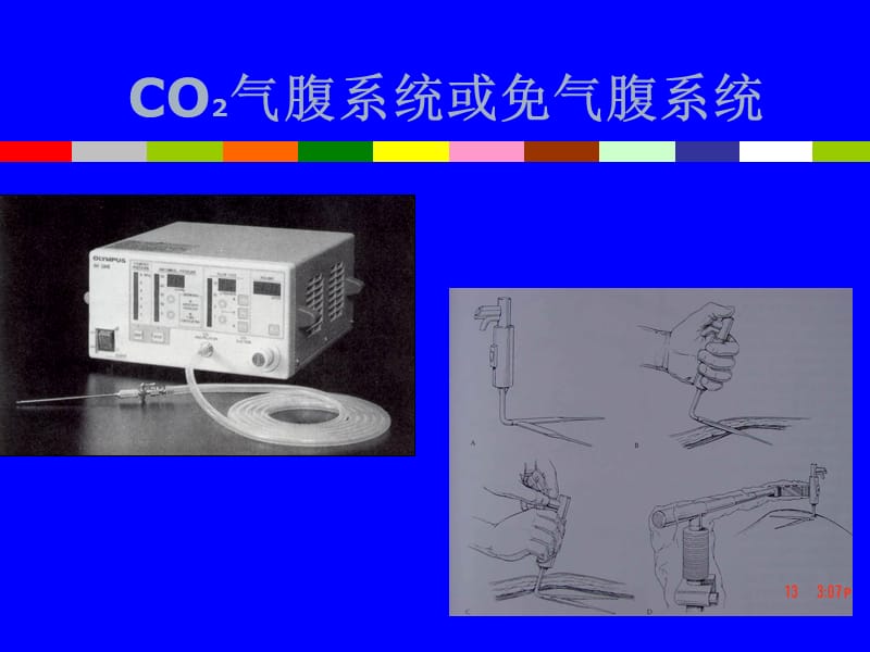 最新肝胆外科腹腔镜技术应用-PPT文档.ppt_第3页