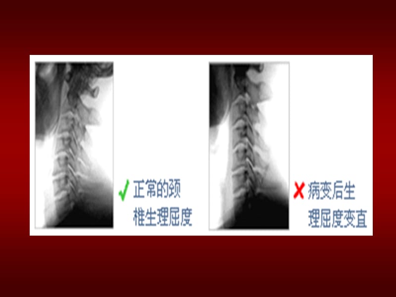 最新颈椎、腰椎病预防,办公室保健知识讲座--治疗仪--武汉红中科技发展有限公司-PPT文档.ppt_第2页