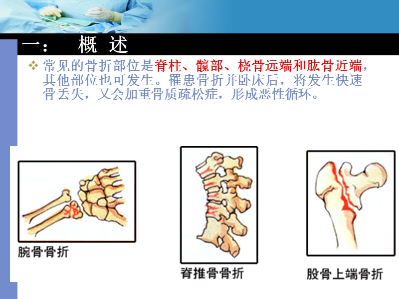 最新：骨质疏松和骨折诊疗课件-文档资料.ppt_第3页