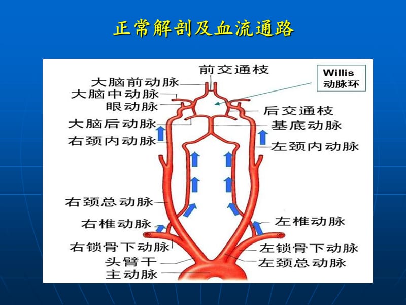 最新：锁骨下动脉盗血综g-文档资料.ppt_第3页