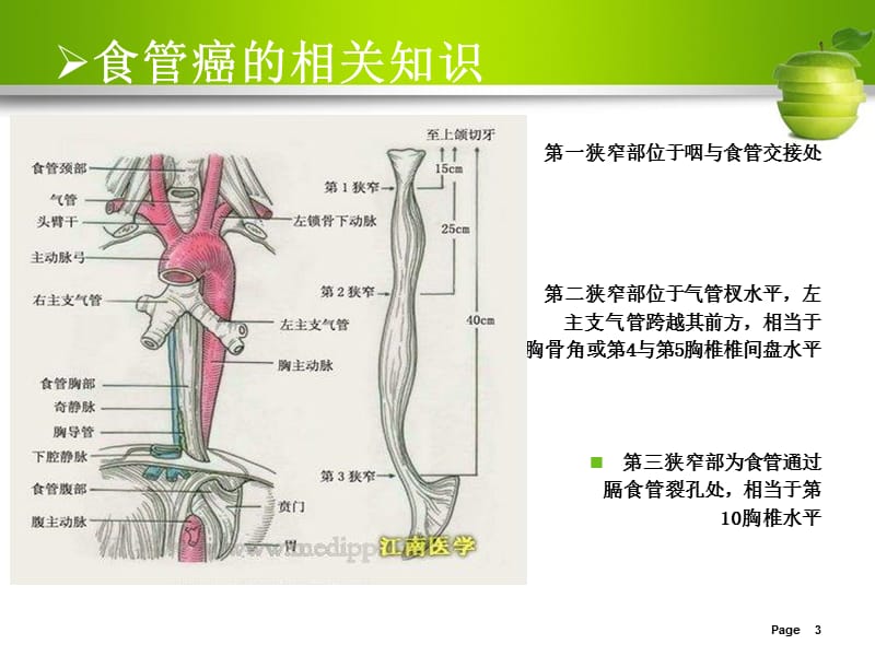 最新：食管癌护理查房10-文档资料.ppt_第3页