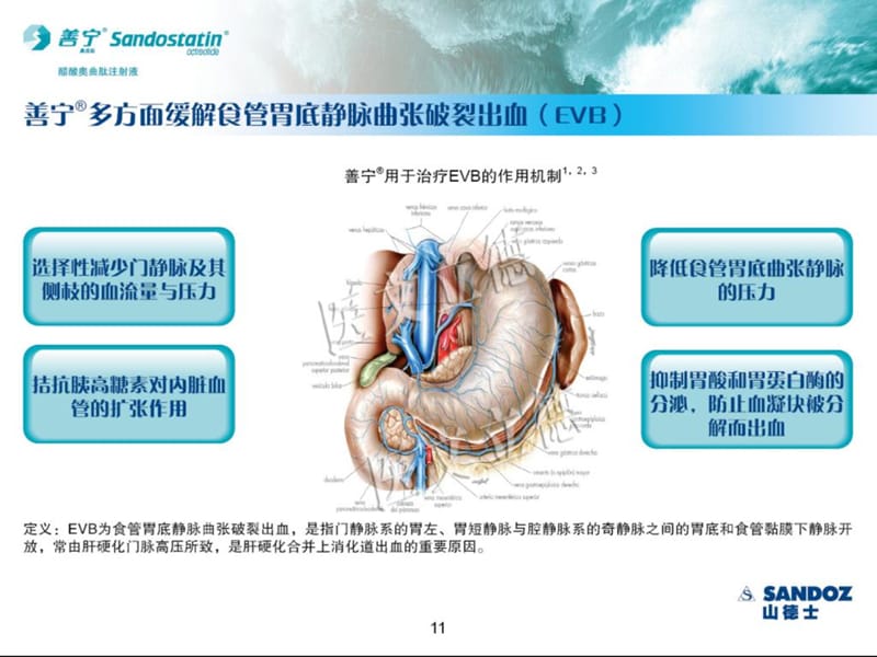 最新善宁在食管胃底静脉曲张破裂出血EVB中的应用-PPT文档.ppt_第3页