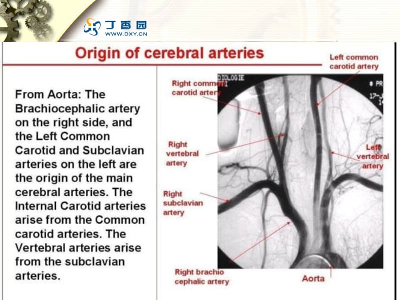 最新：脑血管解剖和造影课件-文档资料.ppt_第2页