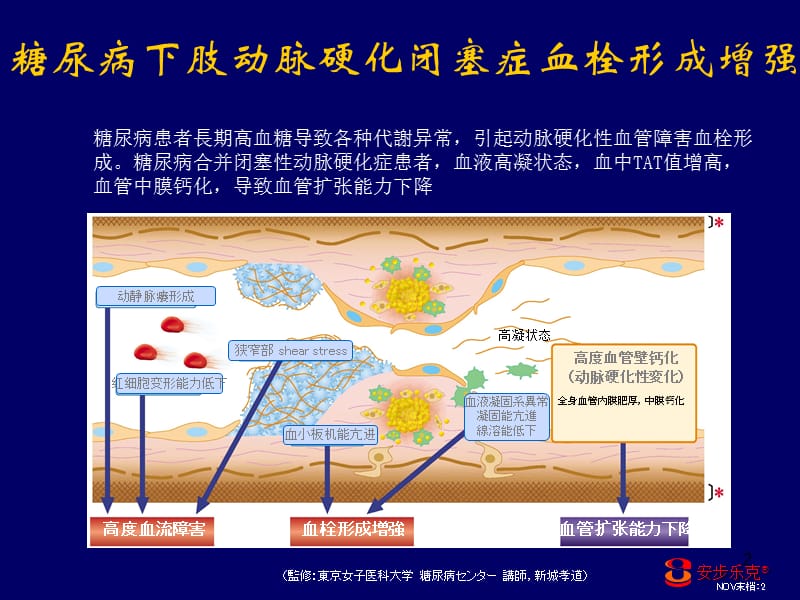 最新安步乐克对糖尿病下肢血管病变的治疗作用-PPT文档.ppt_第2页