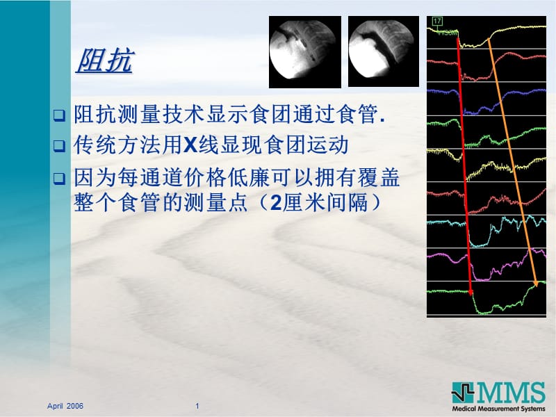 最新：食管腔内ph阻抗压力测量技术ppt课件-文档资料.ppt_第1页