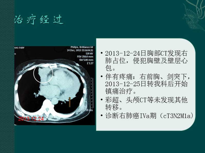 最新疼痛与睡眠障碍-PPT文档.pptx_第3页