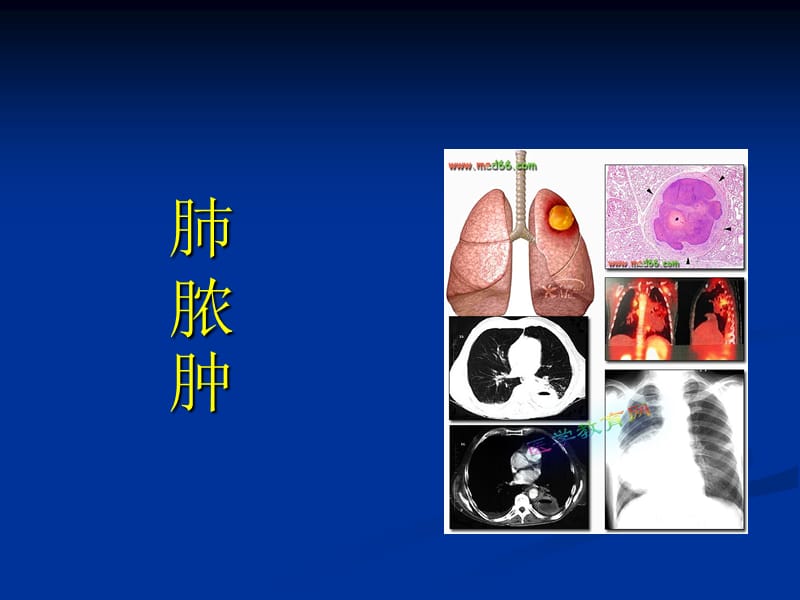 最新例肺脓肿患者的病例汇报-PPT文档.ppt_第3页