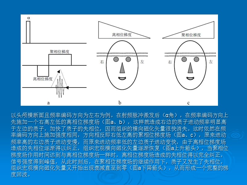 最新GRE梯度回波序列的原理与临床-PPT文档.ppt_第2页