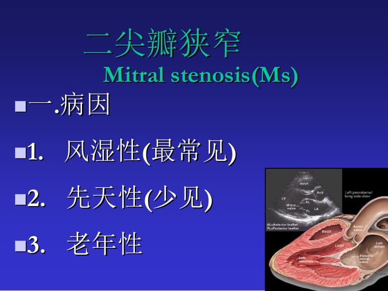 最新彩超瓣膜病1-PPT文档.ppt_第2页