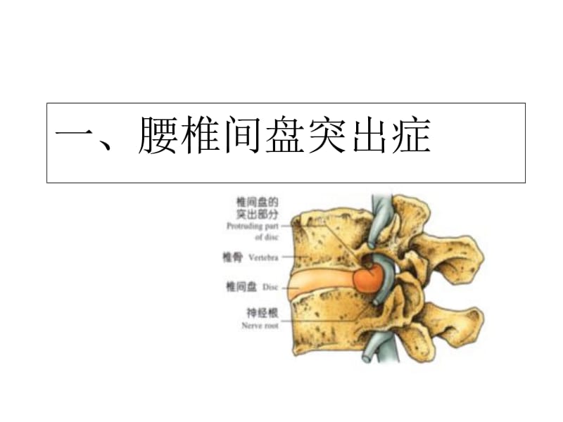 最新颈肩腰腿痛的护理-PPT文档.ppt_第3页