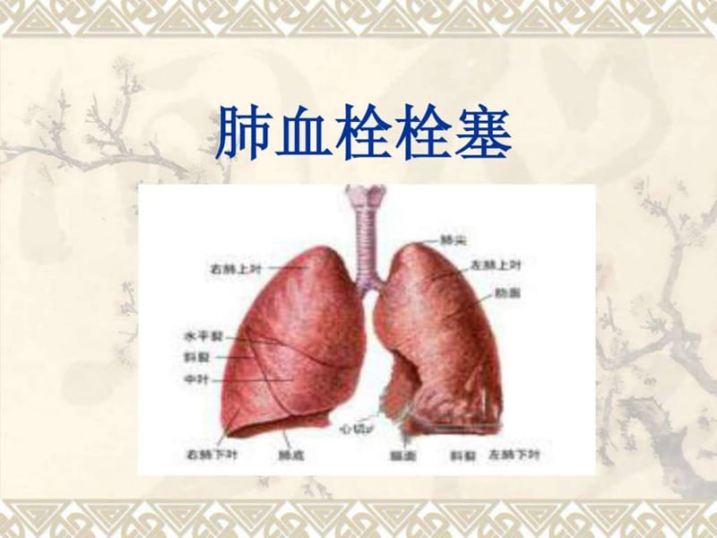 肺栓塞(讲课教学课件).ppt.ppt.ppt_第1页