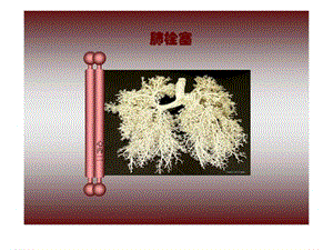 肺栓塞病例图文.ppt.ppt