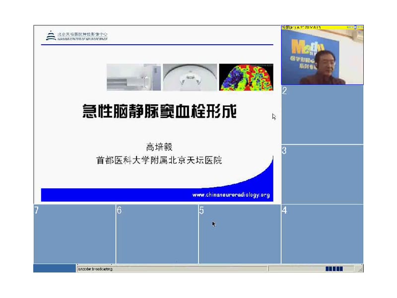 [临床医学]颅内静脉和静脉窦血栓形成的影像学表现.ppt_第1页