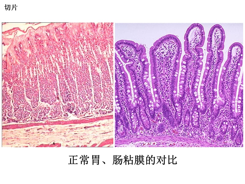 [临床医学]泸州医学院病理考试切片.ppt_第2页