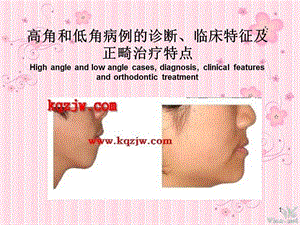 高角和低角病例的诊断、临床特征及正畸治疗特点.ppt