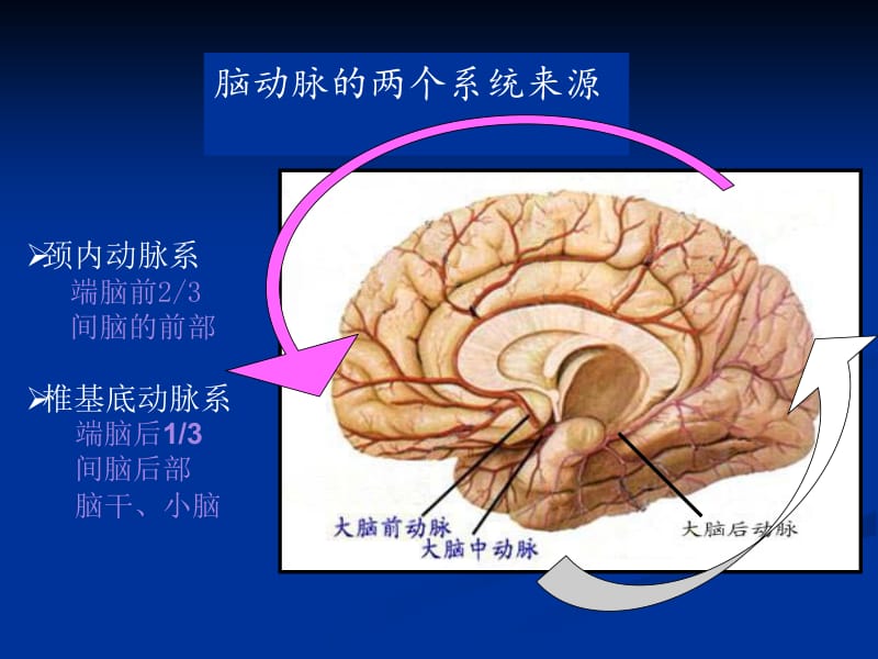 颅内和椎管内血管性疾病.ppt_第3页