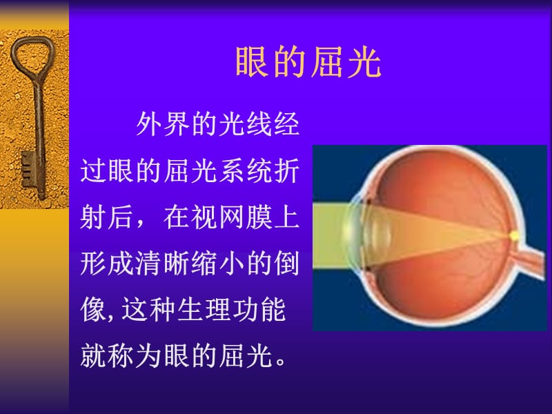 屈光不正与老视 斜视.ppt_第2页