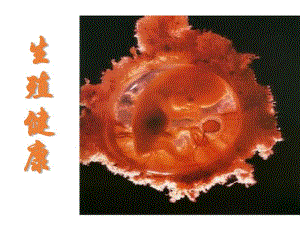 高中生物(人教版)生殖健康课件2课件.pdf