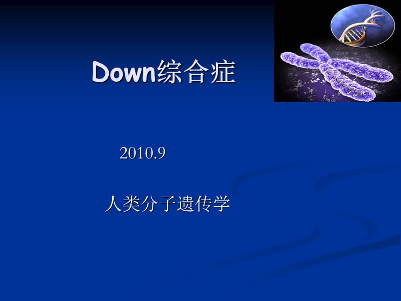 down综合症.ppt_第1页