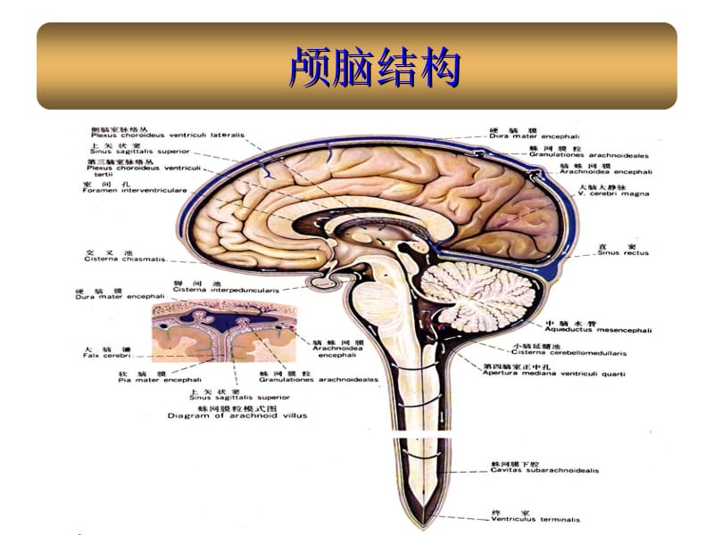 蛛网膜下腔出血护理.ppt_第2页