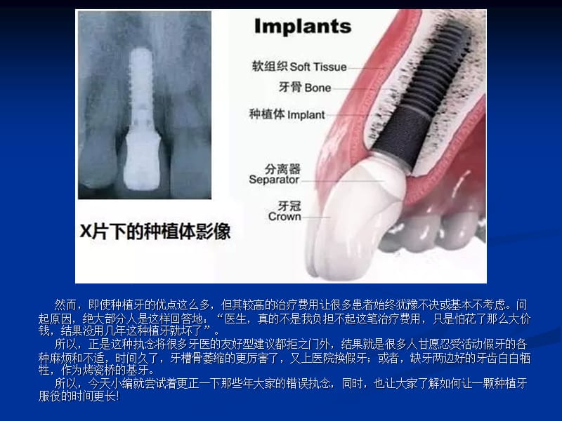 很多人不愿意选择种植牙的真相.ppt_第3页