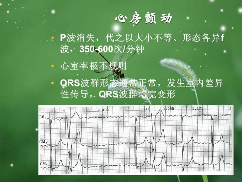 房扑与房颤心电图.ppt_第3页