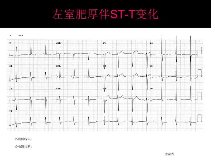 心电图考试完整.ppt_第1页