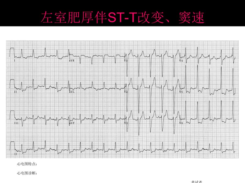 心电图考试完整.ppt_第2页