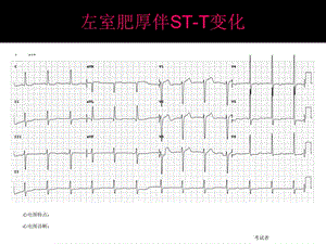 心电图考试完整.ppt