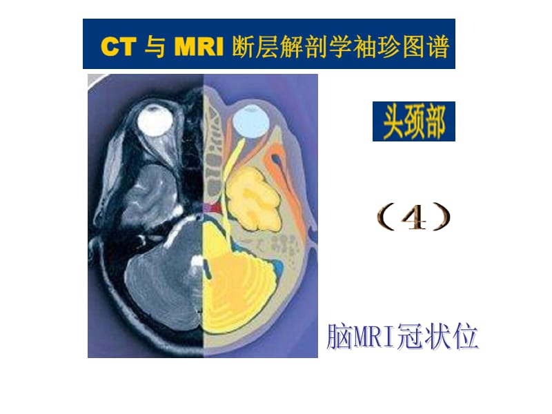 头颈CT-MRI解剖图解系列4.ppt_第2页