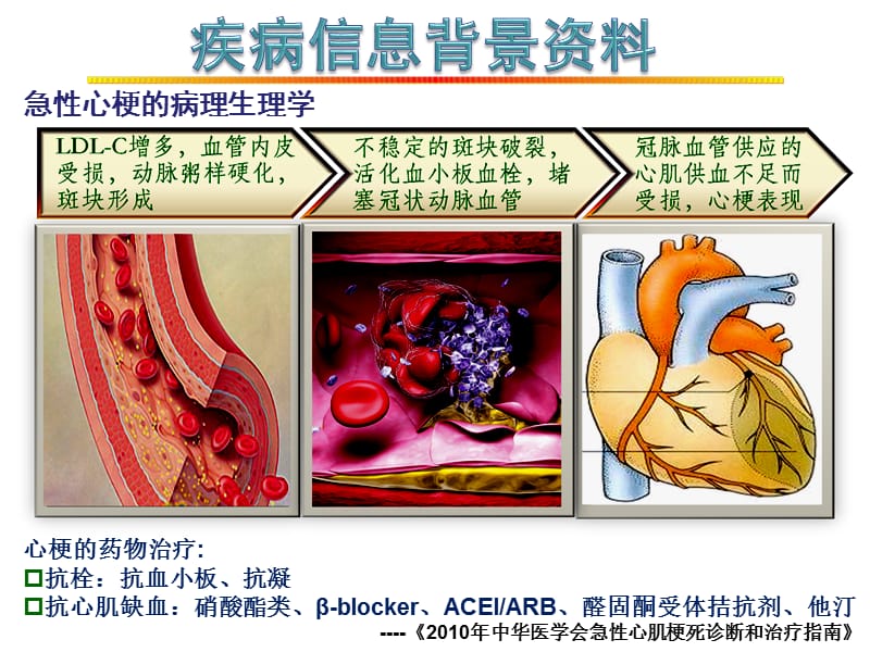 病例分析2-心梗伴代谢综合症.ppt_第2页