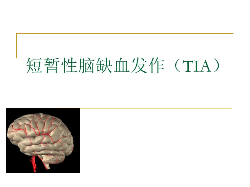 TIA-短暂性脑缺血发作.ppt_第1页