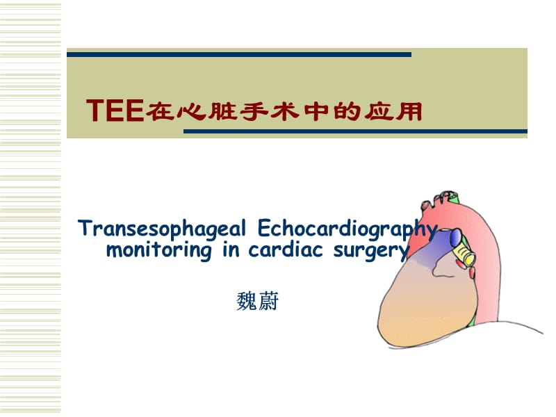 TEE在心脏手术中的应用1.ppt_第1页